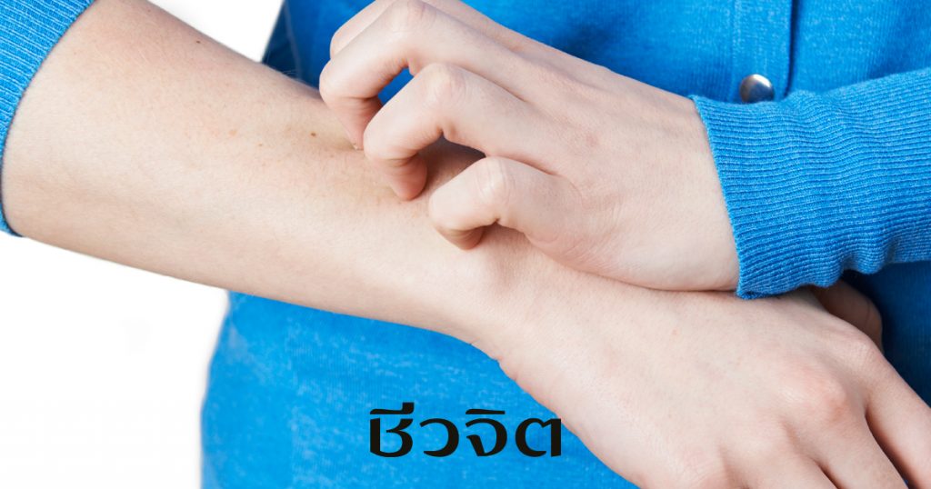 อีสุกอีใส