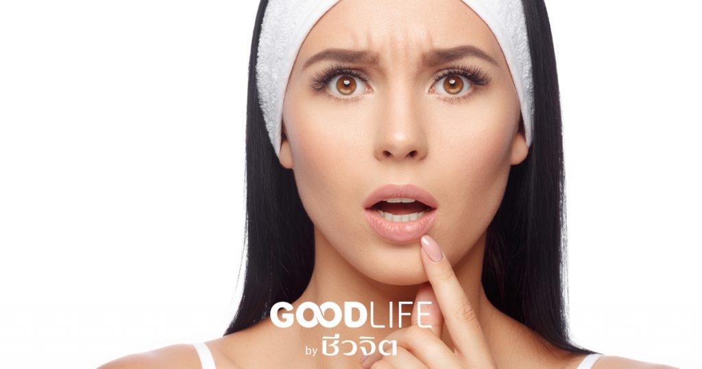 ความเครียด, ติดเชื้อเริม, เริมที่ปาก, เริม, โรคเริม, ป้องกันเริม, รักษาเริม