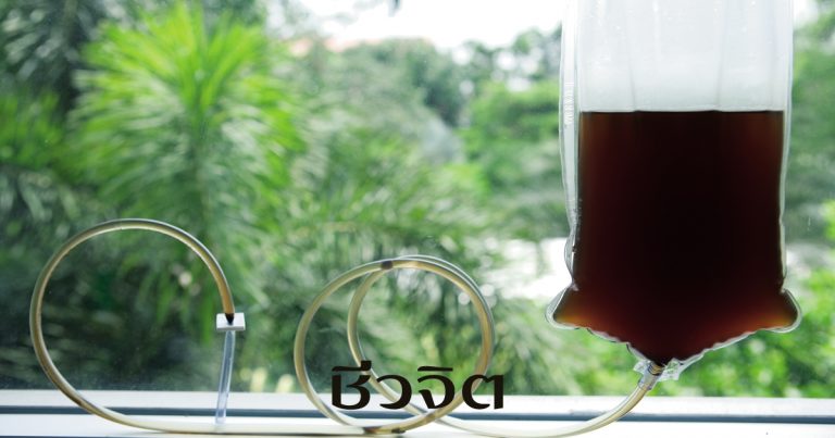 ดีท็อกซ์น้ำกาแฟ, ไมเกรน, ปวดหัวไมเกรน, อาการปวดไมเกรน, ติดหวาน