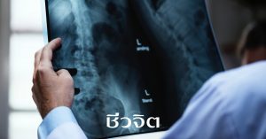 กระดูก, กระดูกพรุน, อาการกระดูกพรุน, โรคกระดูกพรุน, ป้องกันกระดูกพรุน