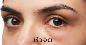 โรคมะเร็ง,เป็นโรคมะเร็ง,มะเร็งเต้านม,โรคมะเร็ง