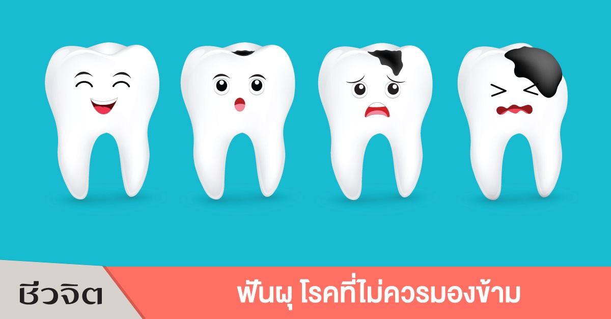 ฟันผุ ปวดฟัน โรคฟันผุ ฟัน ฟันเป็นหนอง เหงือกบวม ช่องปาก ปากและฟัน