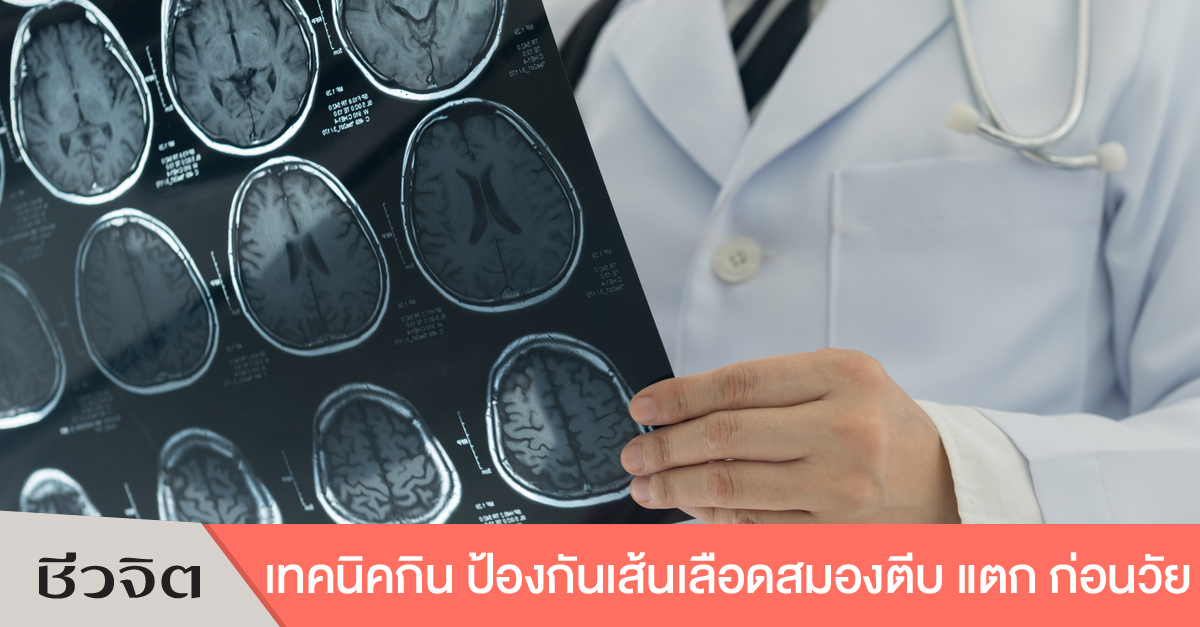 ป้องกันเส้นเลือดในสมองตีบ เส้นเลือดในสมองแตก โรคหลอดเลือดสมองแตก