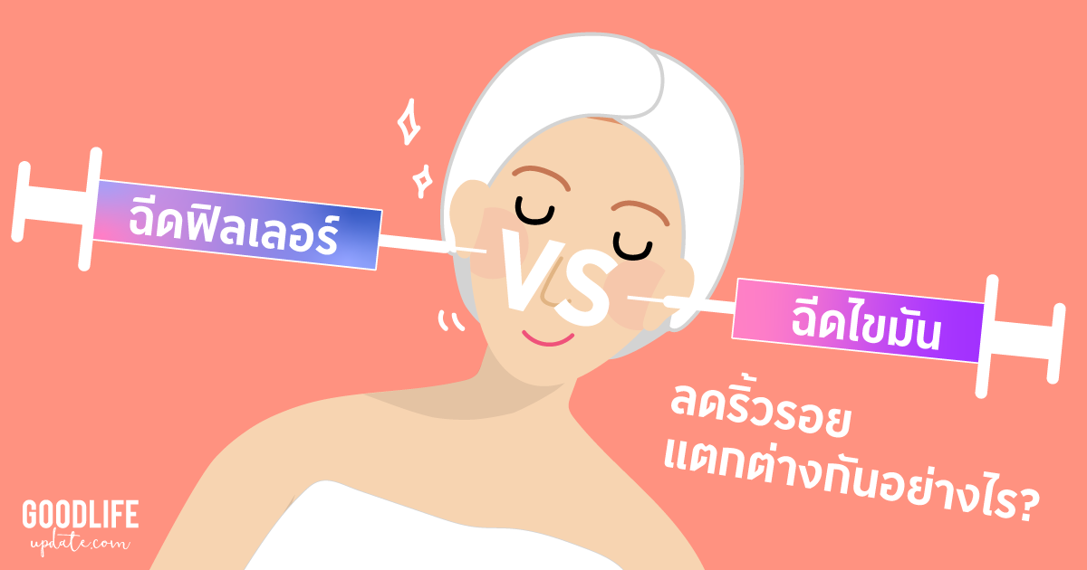 วิธีลบริ้วรอย สร้างผิวเต่งตึง ด้วยการฉีดฟิลเลอร์ และ ฉีดไขมัน แตกต่างกันยังไง?