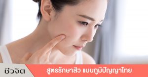 รักษาสิว สิว สูตรแก้สิว สูตรรักษาสิว สูตรธรรมชาติ สูตรสมุนไพรรักษาสิว