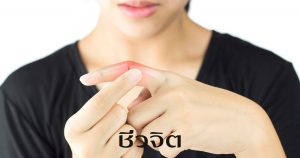 โรคข้ออักเสบรูมาตอยด์ รูมาตอยด์ โรคข้อ ข้อเข่า ข้อต่อ