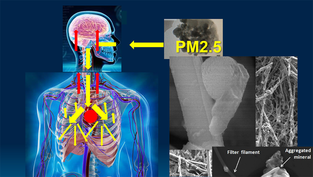 ฝุ่นพิษมรณะ PM2.5