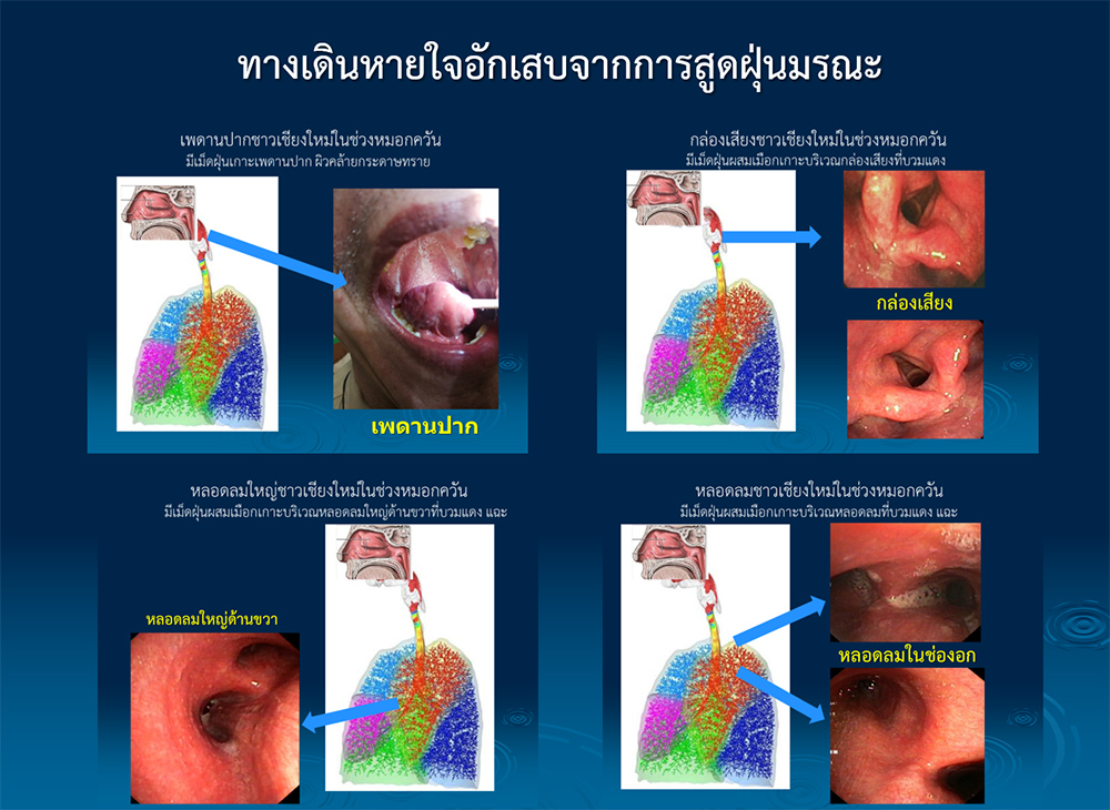 ฝุ่นพิษมรณะ PM2.5