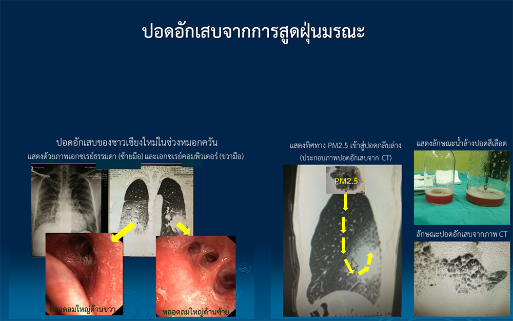 ฝุ่นพิษมรณะ PM2.5