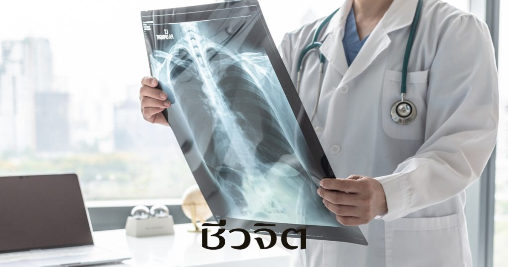 เอ๊กซเรย์ปอด การผ่าตัดรักษาโรคปอด