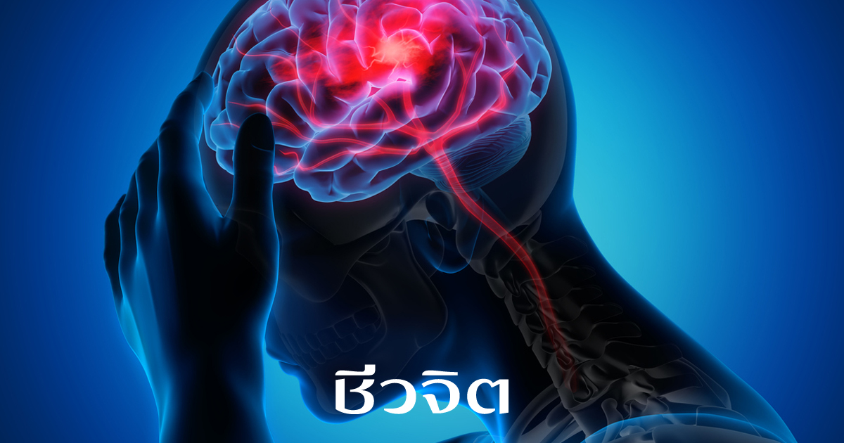 อาการปวดศีรษะแบบไมเกรน