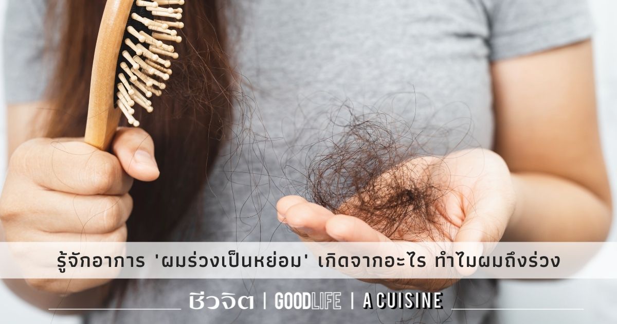 ผมร่วงเป็นหย่อม